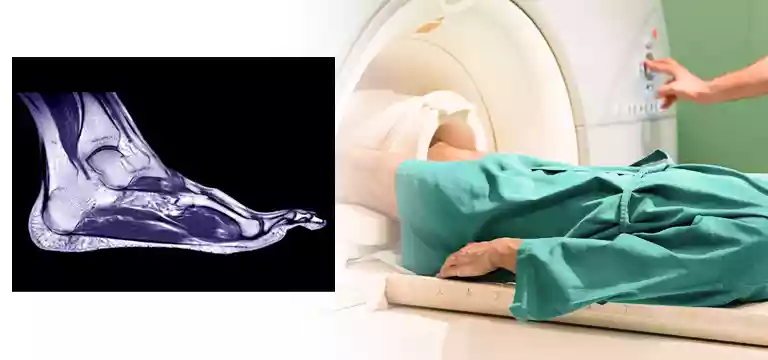 MRI of the Foot: Know details about the process